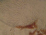 Patinellaria sanguinea image