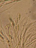 Patinellaria sanguinea image