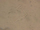 Patinellaria sanguinea image