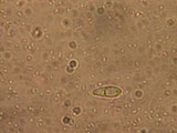 Patinellaria sanguinea image