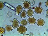 Sphaerosporium lignatile image