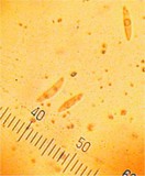 Lachnellula abietis image