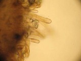Tricharina praecox image