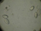 Tricharina praecox image