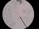 Bovista pila image