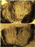 Pertusaria heterochroa image