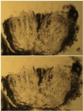 Pertusaria heterochroa image