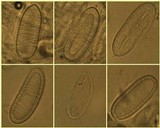 Pertusaria heterochroa image