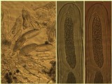Pertusaria heterochroa image