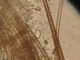 Tricharina ochroleuca image