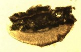 Lecanora carpinea image