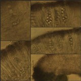 Lecanora carpinea image