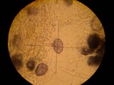 Aleurodiscus grantii image