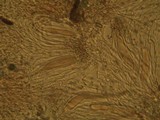 Phlyctis agelaea image