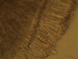 Lecidella elaeochroma f. elaeochroma image