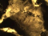 Pertusaria hymenea image