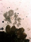 Nectria peziza image