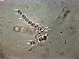 Nectria peziza image