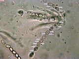 Nectria peziza image
