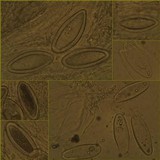Pertusaria hymenea image