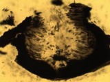Pyrenula macrospora image
