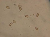 Inocybe glabrescens image