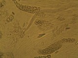 Thelopsis isiaca image