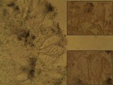 Arthonia radiata image