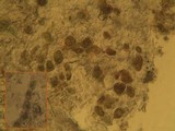 Arthonia radiata image