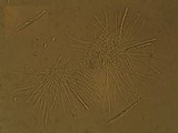Dimerella lutea image