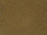 Dimerella lutea image