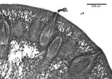 Claviceps purpurea image