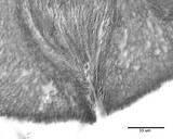 Claviceps purpurea image