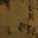 Arthonia stellaris image