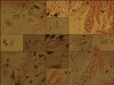 Caloplaca ochracea image