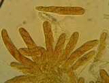 Melanomma subdispersum image