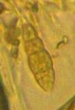 Melanomma subdispersum image