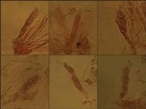 Collema tenax var. tenax image
