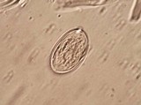 Aleurodiscus oakesii image