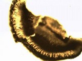Pyxine subcinerea image
