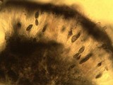 Pyxine subcinerea image