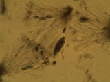 Pyxine subcinerea image