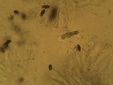 Pyxine subcinerea image