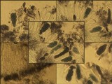 Diplotomma hedinii image