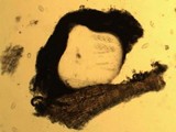 Julella vitrispora image