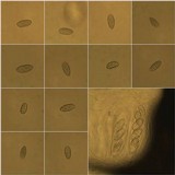 Julella vitrispora image