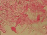 Melanoleuca cognata image