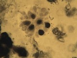 Sclerococcum sphaerale image