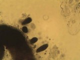 Sclerococcum sphaerale image