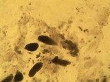 Sclerococcum sphaerale image